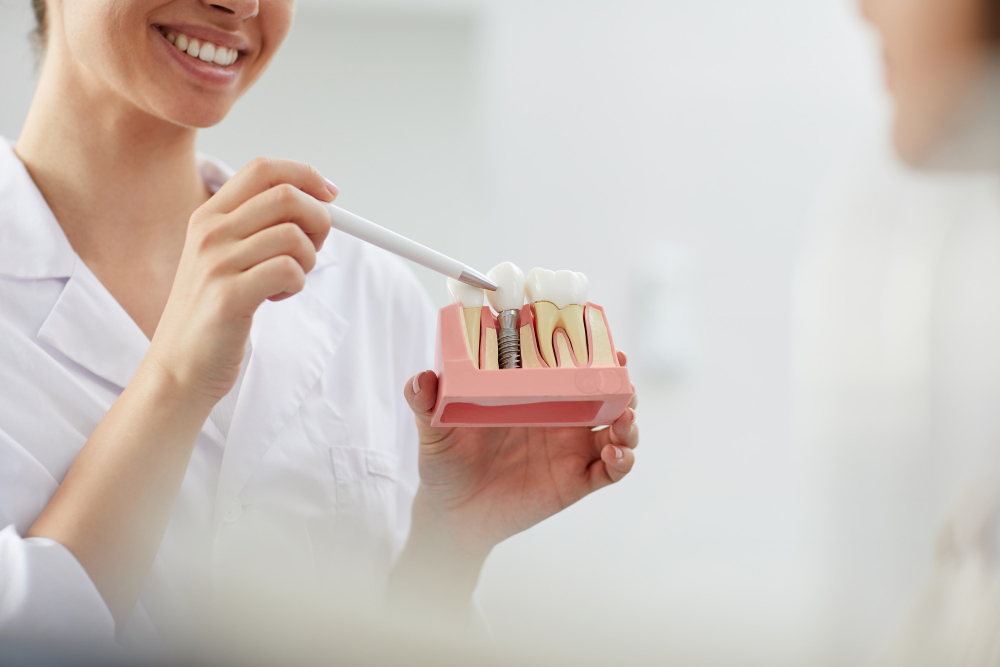 Implante dentário em Piraju: solução fixa para recuperar seu sorriso com segurança